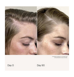 living-proof-scalp-care-density-serum-50-ml-342359-2660