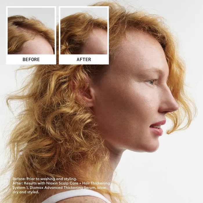 nioxin-scalp-hair-system-1-treatment-100-ml-337435-2425